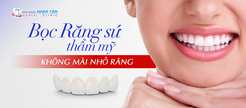 Răng sứ công nghệ cao tại nha khoa Nhân Tâm