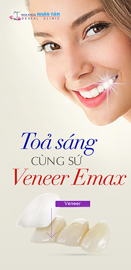 Răng sứ công nghệ cao