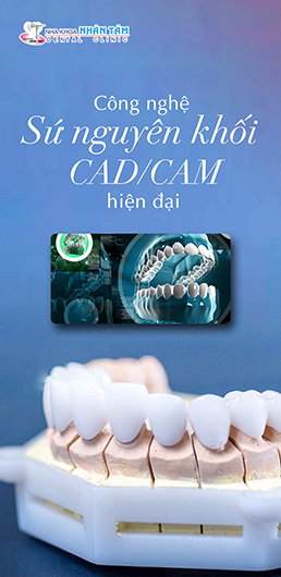 Răng sứ công nghệ cao sài gòn
