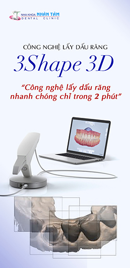 Công nghệ lấy dấu răng