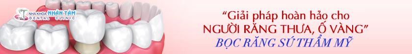 Bọc răng sứ thẩm mỹ