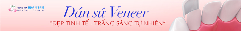 dán sứ đẹp tinh tế
