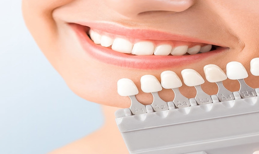 Thế nào là răng sứ không kim loại Cercon?