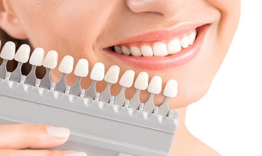 Lưu ý gì khi làm răng toàn sứ? Nha khoa làm răng sứ thẩm mỹ tốt tại HCM ở đâu?