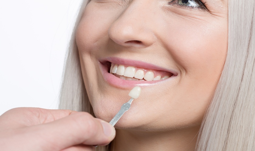 Mách nhỏ loại răng sứ đẹp và nơi làm răng sứ thẩm mỹ uy tín tại quận 10