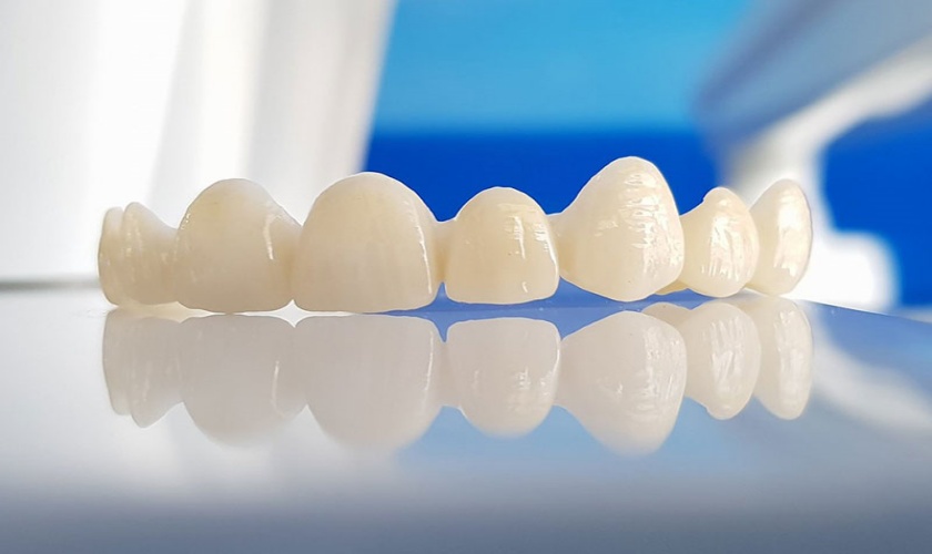 Bọc răng sứ Cercon hay Zirconia còn phụ thuộc vào nhu cầu của từng bệnh nhân